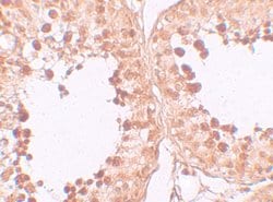 Invitrogen CRISP2 Polyclonal Antibody 100 &mu;g | Buy Online | Invitrogen&trade; | Fisher Scientific