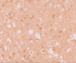 Invitrogen TRIM71 Polyclonal Antibody 100 &mu;g | Buy Online | Invitrogen&trade; | Fisher Scientific
