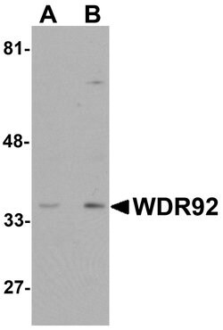 Invitrogen WDR92 Polyclonal Antibody 100 &mu;g | Buy Online | Invitrogen&trade; | Fisher Scientific