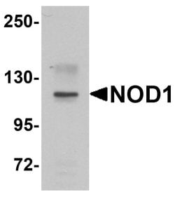 Invitrogen NOD1 Polyclonal Antibody 100 &mu;g | Buy Online | Invitrogen&trade; | Fisher Scientific