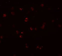 Invitrogen NOD3 Polyclonal Antibody 100 &mu;g; Unconjugated:Antibodies,