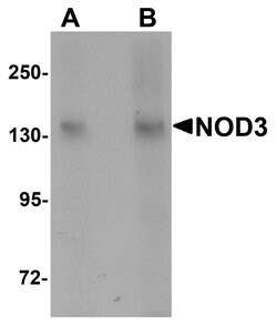 Invitrogen NOD3 Polyclonal Antibody 100 &mu;g; Unconjugated:Antibodies,