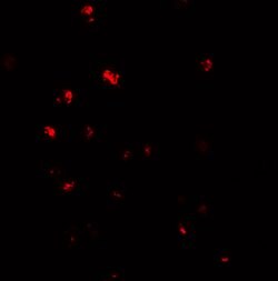 Invitrogen NOD4 Polyclonal Antibody 100 &mu;g; Unconjugated:Antibodies,
