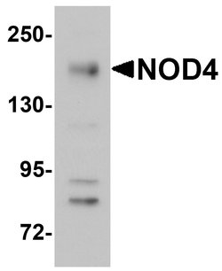 Invitrogen NOD4 Polyclonal Antibody 100 &mu;g; Unconjugated:Antibodies,