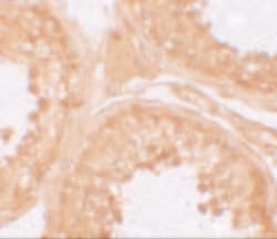 Invitrogen NALP9 Polyclonal Antibody 100 μg; Unconjugated:Antibodies,