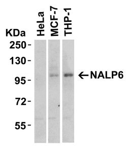 Invitrogen NLRP6 Polyclonal Antibody 100 &mu;g; Unconjugated:Antibodies,