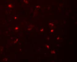 Invitrogen NLRP6 Polyclonal Antibody 100 &mu;g; Unconjugated:Antibodies,