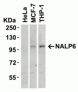 Invitrogen NLRP6 Polyclonal Antibody 100 &mu;g; Unconjugated:Antibodies,