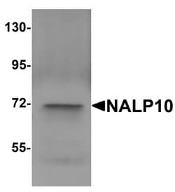 Invitrogen NALP10 Polyclonal Antibody 100 &mu;g; Unconjugated:Antibodies,