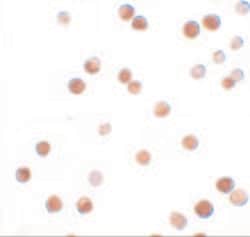 NALP11 Polyclonal Antibody, Invitrogen 100 &mu;g; Unconjugated:Antibodies