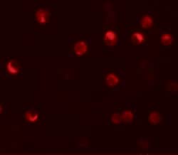NALP11 Polyclonal Antibody, Invitrogen 100 &mu;g; Unconjugated:Antibodies