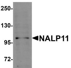 NALP11 Polyclonal Antibody, Invitrogen 100 &mu;g; Unconjugated:Antibodies