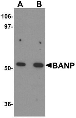 Invitrogen BANP Polyclonal Antibody 100 &mu;g; Unconjugated:Antibodies,