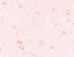 Invitrogen CIITA Polyclonal Antibody 100 &mu;g; Unconjugated:Antibodies,