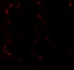 Invitrogen KPNA6 Polyclonal Antibody 100 &mu;g | Buy Online | Invitrogen&trade; | Fisher Scientific