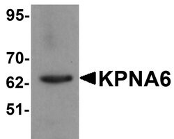 Invitrogen KPNA6 Polyclonal Antibody 100 &mu;g | Buy Online | Invitrogen&trade; | Fisher Scientific