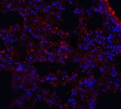 Invitrogen MFSD2A Polyclonal Antibody 100 &mu;g; Unconjugated:Antibodies,