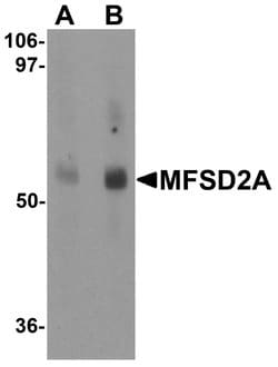 Invitrogen MFSD2A Polyclonal Antibody 100 &mu;g; Unconjugated:Antibodies,