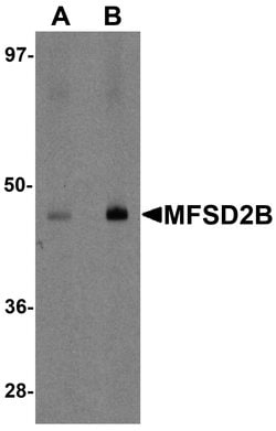 MFSD2B Polyclonal Antibody:Antibodies, Polyclonal