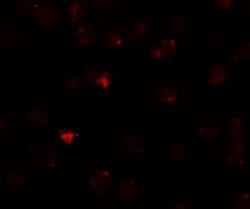 Invitrogen PIWIL3 Polyclonal Antibody 100 &mu;g | Buy Online | Invitrogen&trade; | Fisher Scientific