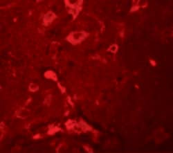 Invitrogen APBA2 Polyclonal Antibody 100 &mu;g | Buy Online | Invitrogen&trade; | Fisher Scientific