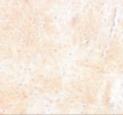 Invitrogen SYNPO2 Polyclonal Antibody 100 &mu;g | Buy Online | Invitrogen&trade; | Fisher Scientific