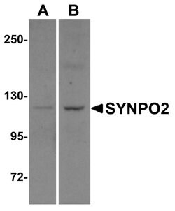 Invitrogen SYNPO2 Polyclonal Antibody 100 &mu;g | Buy Online | Invitrogen&trade; | Fisher Scientific