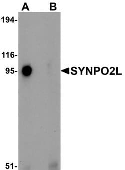 SYNPO2L Polyclonal Antibody:Antibodies, Polyclonal