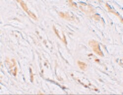 PEAR1 Polyclonal Antibody:Antibodies, Polyclonal