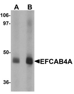 EFCAB4A Polyclonal Antibody 100 &mu;g | Buy Online | Invitrogen | Fisher Scientific