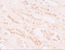 EFCAB4B Polyclonal Antibody:Antibodies, Polyclonal