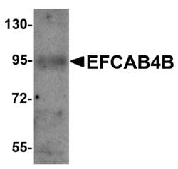 EFCAB4B Polyclonal Antibody:Antibodies, Polyclonal