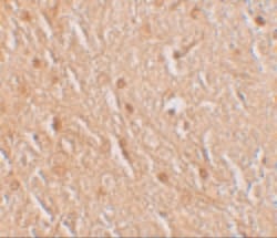 Invitrogen LMBRD1 Polyclonal Antibody 100 &mu;g; Unconjugated:Antibodies,