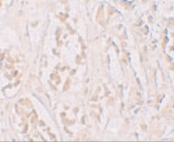 Invitrogen STOX2 Polyclonal Antibody 100 &mu;g | Buy Online | Invitrogen&trade; | Fisher Scientific