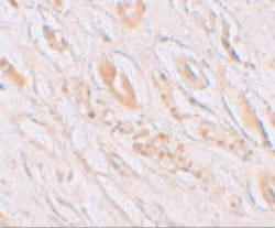 TMEM59 Polyclonal Antibody:Antibodies, Polyclonal