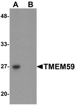 TMEM59 Polyclonal Antibody:Antibodies, Polyclonal