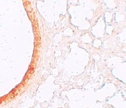 Invitrogen SLC39A3 Polyclonal Antibody 100 &mu;g; Unconjugated:Antibodies,