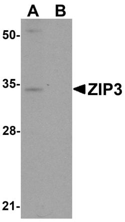 Invitrogen SLC39A3 Polyclonal Antibody 100 &mu;g; Unconjugated:Antibodies,