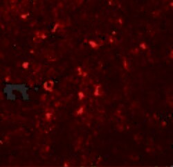 Invitrogen SLC39A5 Polyclonal Antibody 100 &mu;g | Buy Online | Invitrogen&trade; | Fisher Scientific