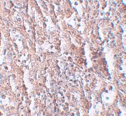 Invitrogen SLC39A5 Polyclonal Antibody 100 &mu;g | Buy Online | Invitrogen&trade; | Fisher Scientific