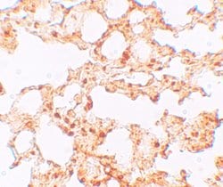 SLC39A6 Polyclonal Antibody:Antibodies, Polyclonal
