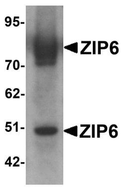 SLC39A6 Polyclonal Antibody:Antibodies, Polyclonal