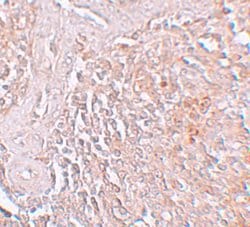 Invitrogen SLC39A8 Polyclonal Antibody 100 &mu;g; Unconjugated:Antibodies,