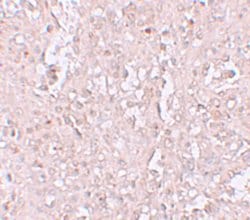 Invitrogen ZIP13 Polyclonal Antibody 100 &mu;g; Unconjugated:Antibodies,