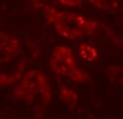 Invitrogen DPF2 Polyclonal Antibody 100 &mu;g; Unconjugated:Antibodies,