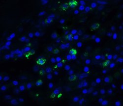 Invitrogen TFF3 Polyclonal Antibody 100 &mu;g; Unconjugated:Antibodies,