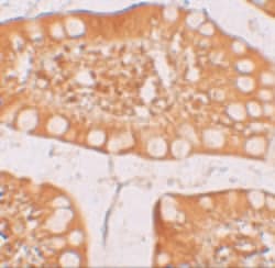 Invitrogen TFF3 Polyclonal Antibody 100 &mu;g; Unconjugated:Antibodies,