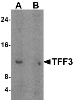 Invitrogen TFF3 Polyclonal Antibody 100 &mu;g; Unconjugated:Antibodies,