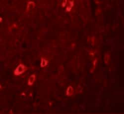 Invitrogen ZBTB3 Polyclonal Antibody 100 μg; Unconjugated:Antibodies,