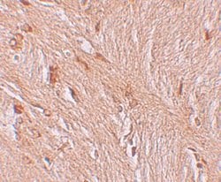 Invitrogen ZBTB3 Polyclonal Antibody 100 μg; Unconjugated:Antibodies,